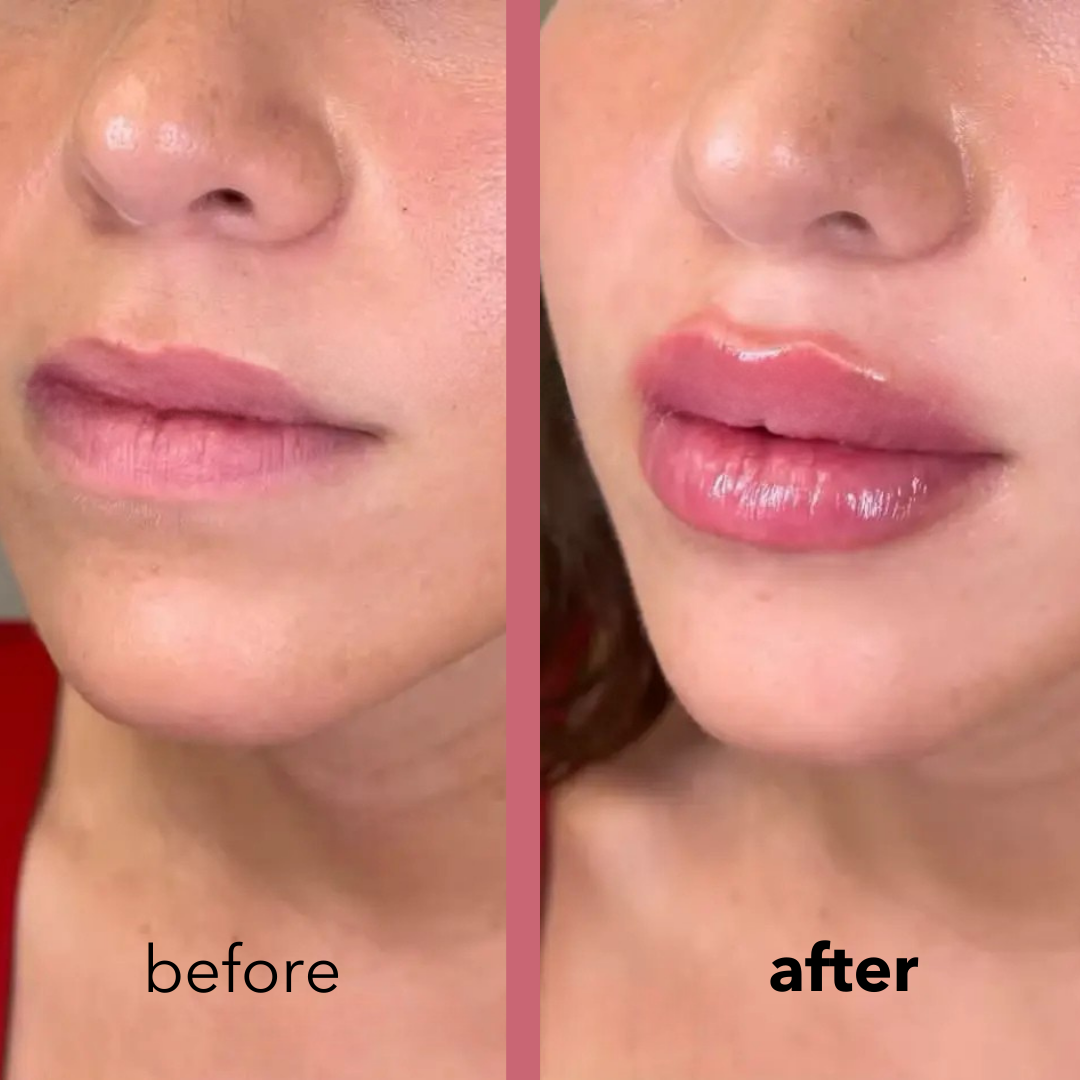 Everlasting Lip Plumper (Buy 1 Get 1 FREE!)